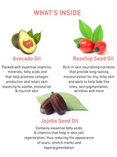 Load image into Gallery viewer, Stretch Mark Oil
